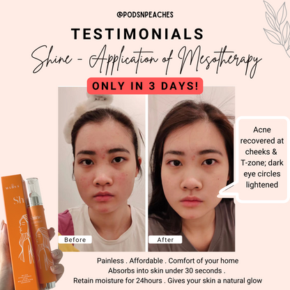 Mliss Shine Hyaluronic Acid Essence