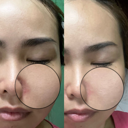 SOM1 Mins Cleansing Gel