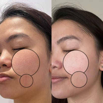 SOM1 Mins Toner Pad