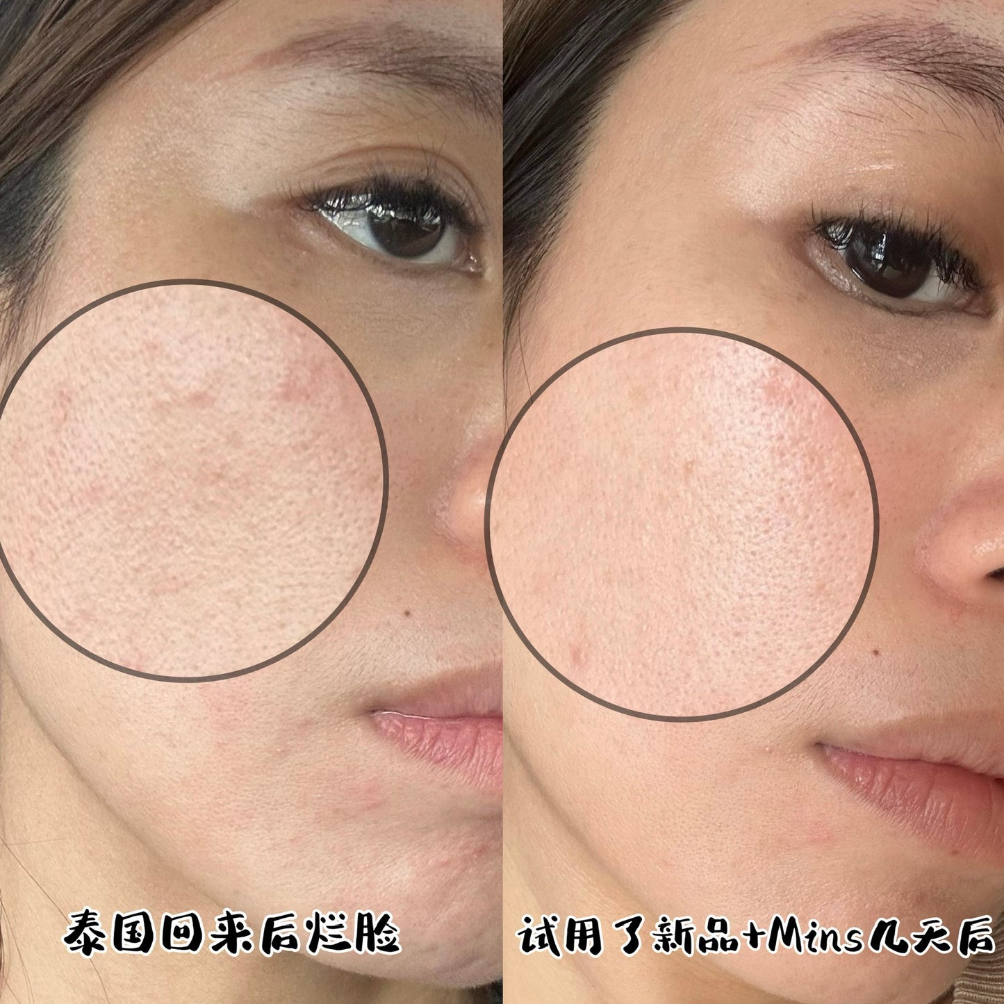 SOM1 Mins Toner Pad