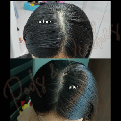 SOM1 SDEEN Root Booster